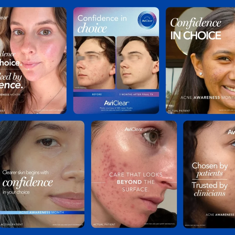 Acne Awareness Socials